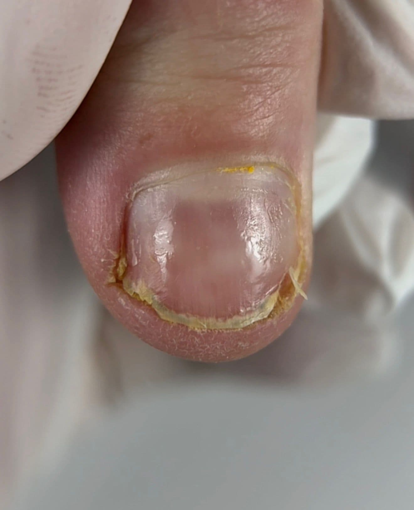 Before complex case