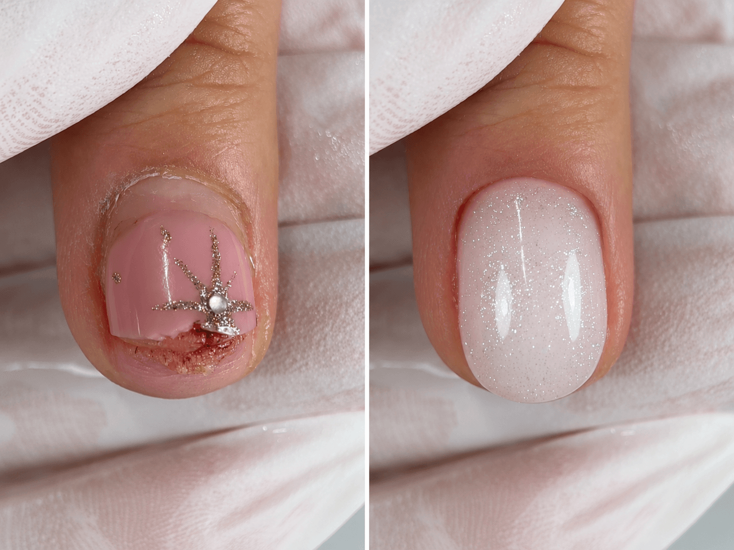Before / After: An injured nail: when you can’t just coat over it