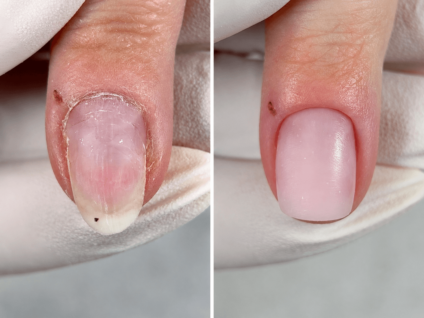 Before / After: Deformation and overload in the stress zone