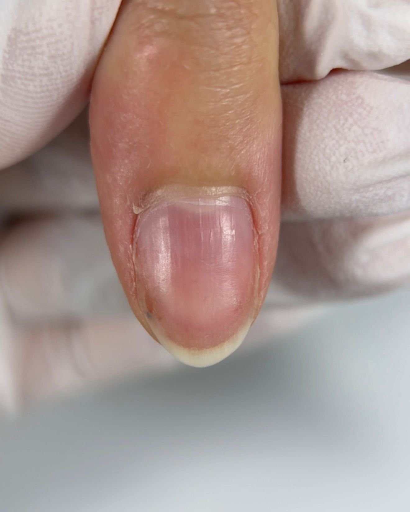 Before difficult sticky cuticle work