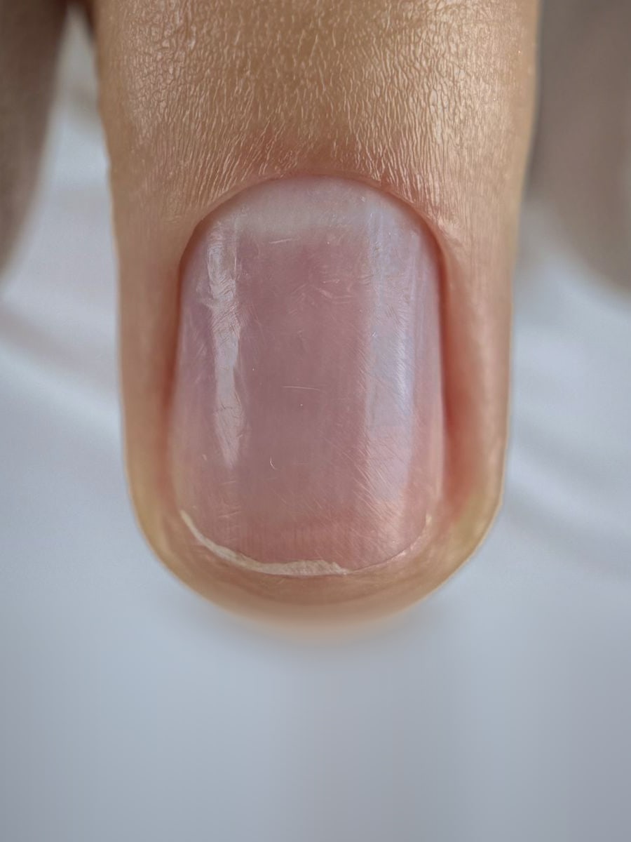 Perfect Cuticle Technique